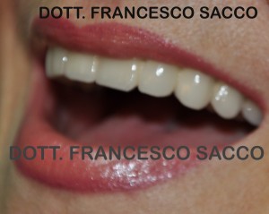 Studio Dentistico Sacco Estetica Dentale