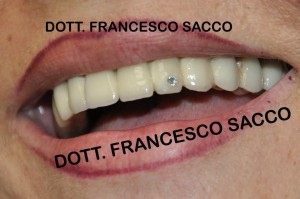 Studio Dentistico Sacco Estetica Dentale