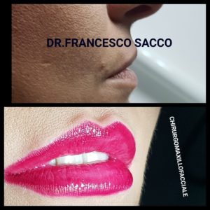 MEDICINA ESTETICA SALA CONSILINA DR. FRANCESCO SACCO