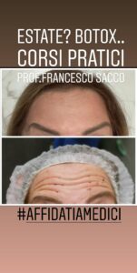 Medicina Estetica Sala Consilina Dr. Francesco Sacco botox